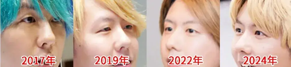 藤澤涼架の昔と今の顔を比較した画像